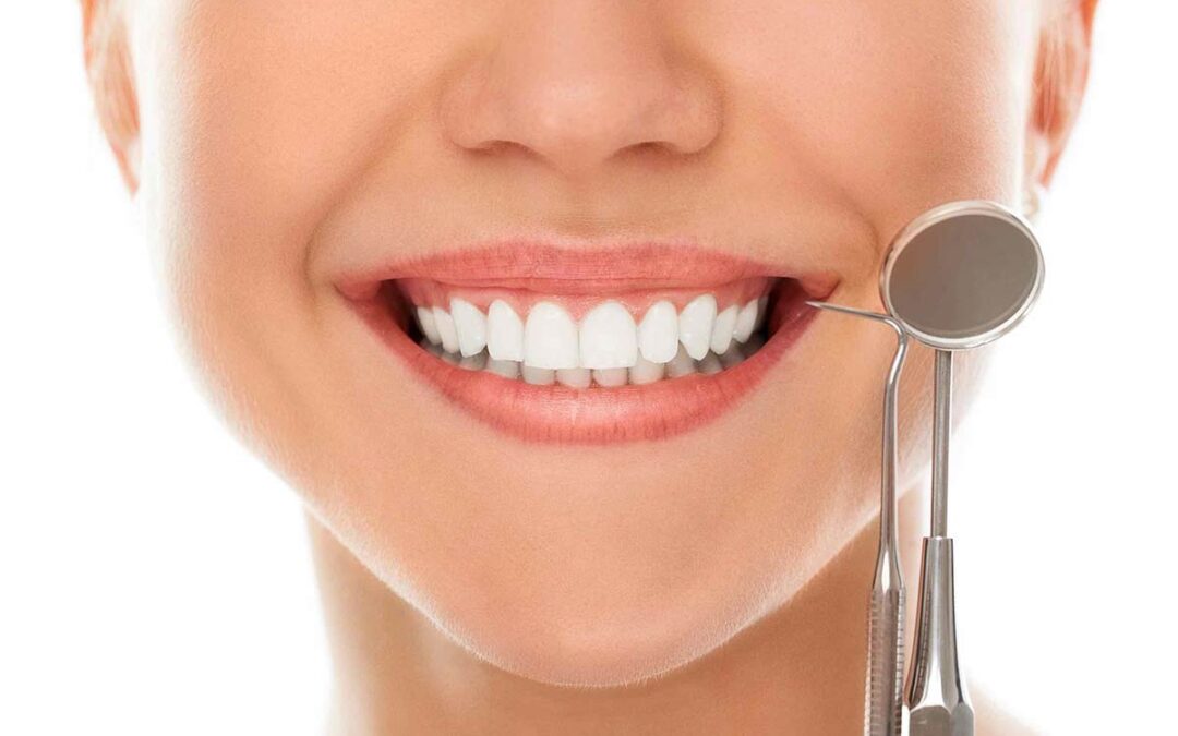 Tratamientos de estética dental